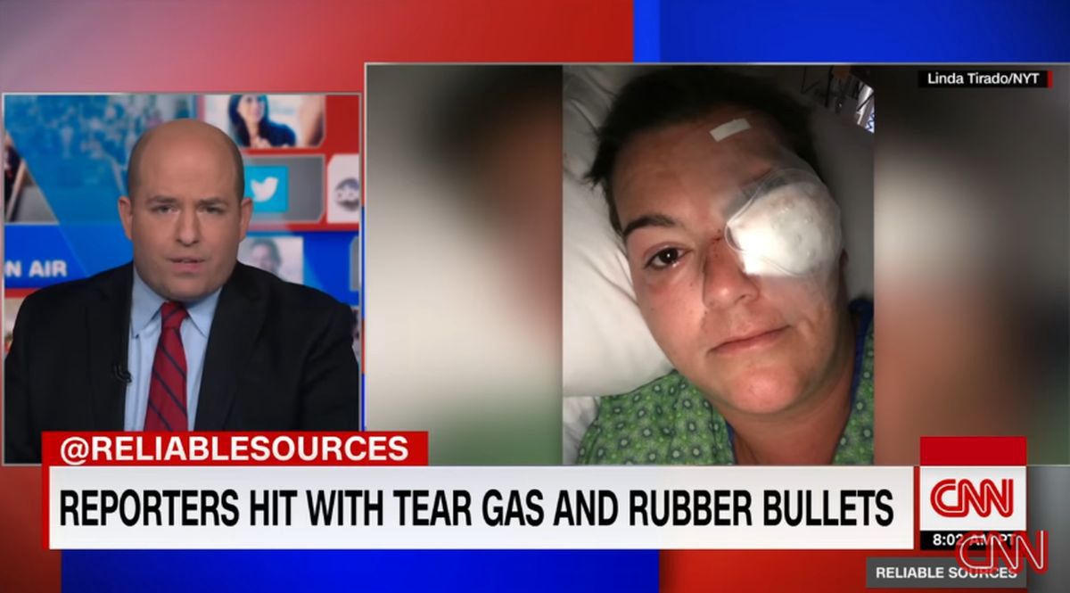 Reporterka Linda Tirado straciła oko po ataku przez policję podczas zamieszek w Minneapolis.