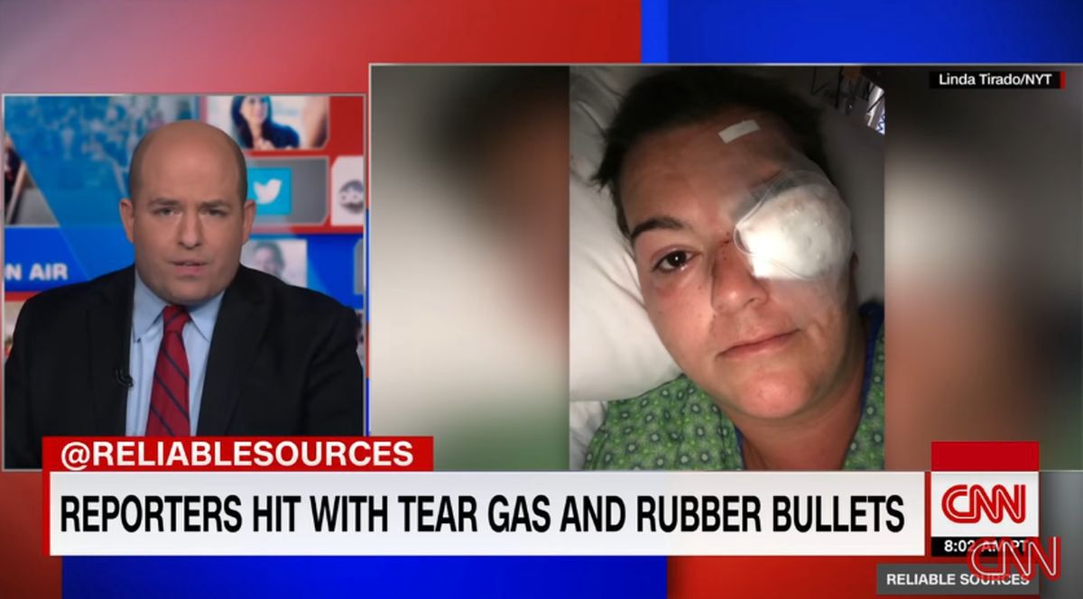 Reporterka Linda Tirado straciła oko po ataku przez policję podczas zamieszek w Minneapolis.