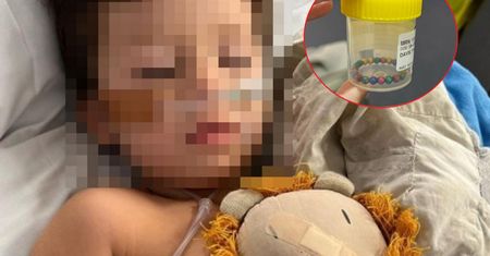 Chłopiec połknął 22 magnetyczne kulki. "Jeśli twoje dziecko ma tę zabawkę, wyrzuć ją"