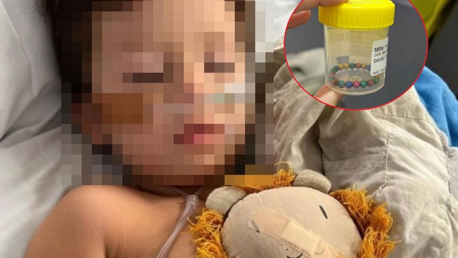 Temat magnetycznych zabawek powraca. Chłopiec połknął 22 magnetyczne kulki - konieczna była operacja