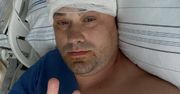 Adrian Szymaniak ze "ŚOPW" przekazał nowe informacje o leczeniu glejaka. "Wiele osób walczy po cichu"