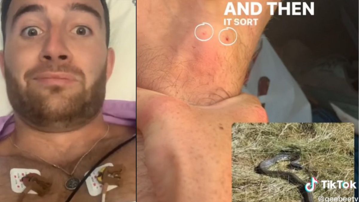 Ugryzł go jadowity wąż.