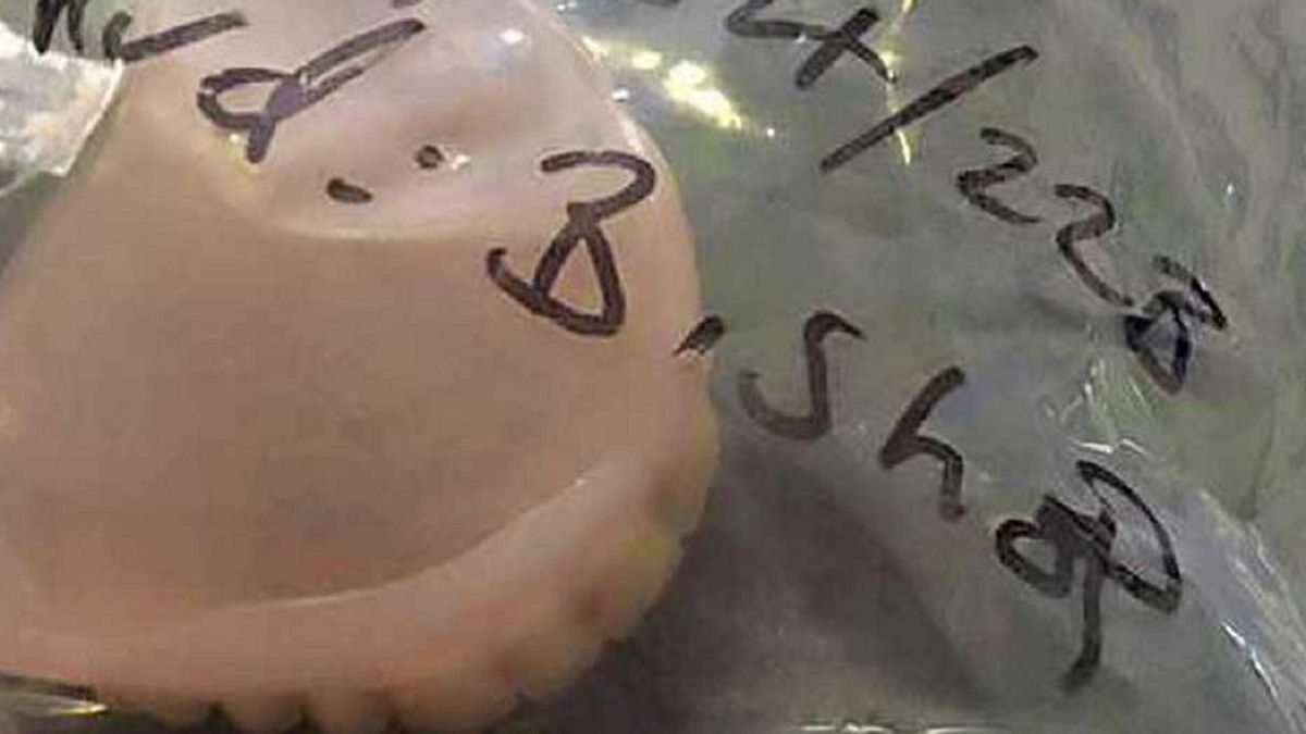 Mężczyzna odzyskał sztuczną szczękę, którą zgubił w Hiszpanii na imprezie.