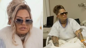 Laluna podejmuje się operacji zmniejszania żołądka. "Jestem teraz utyta jak świnia" (WIDEO)