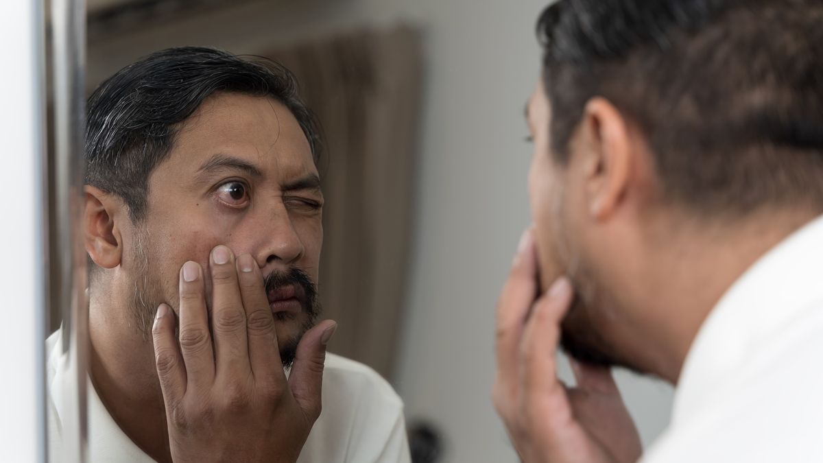 Man looking at red eye in mirror checking irritation or infection health problem concept vision healthcare
Close up portrait of man examining red eye in mirror, concept of health problem, infection, irritation, vision care, ophthalmology, medical condition, diagnosis, healthcare, awareness and prevention.
jittawit.21