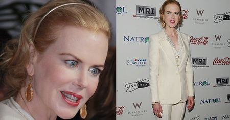 Zupełnie gładkie czoło Kidman...
