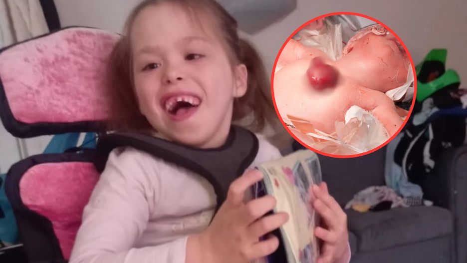 Przyszła na świat z rzadką wadą rozwojową