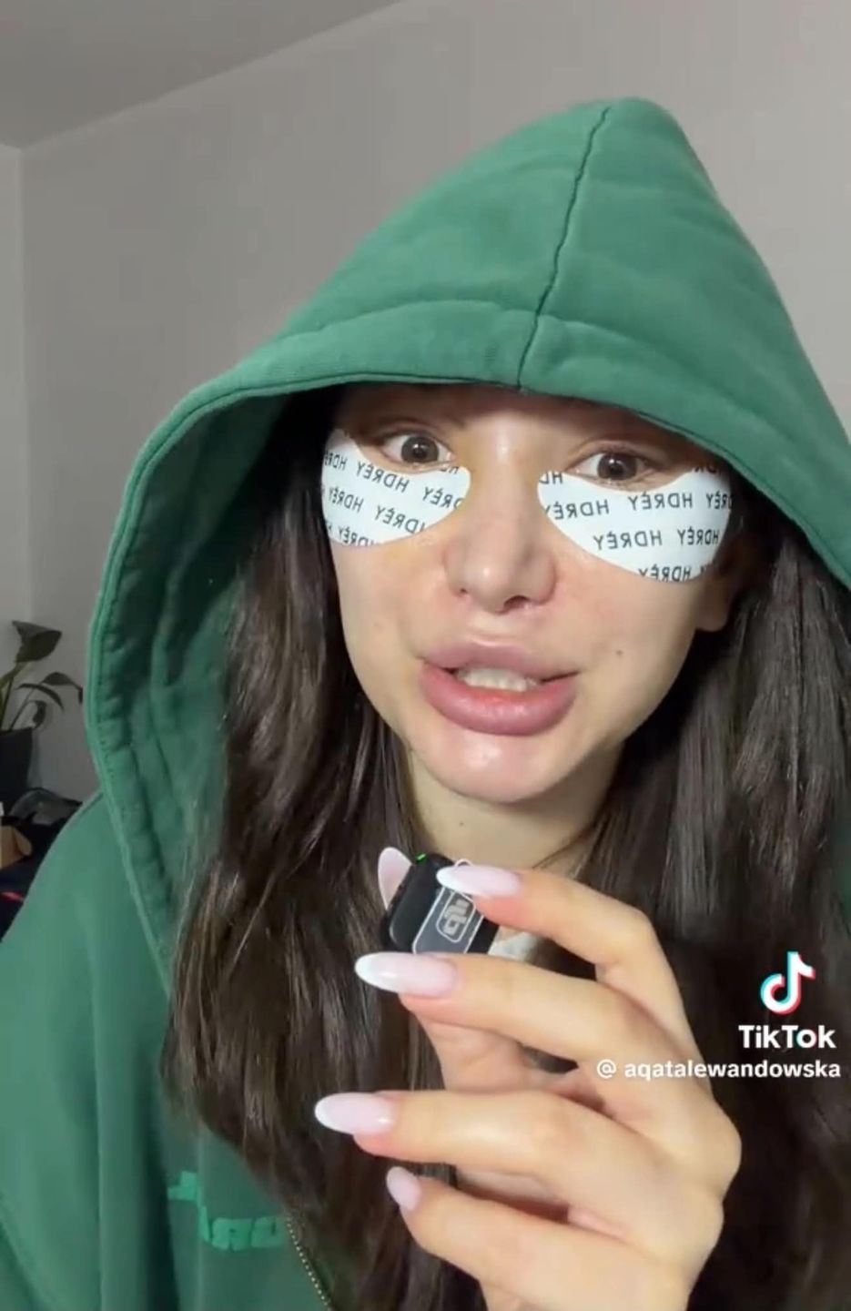 Agata Lewandowska pokazała twarz tydzień po liftingu skroniowym