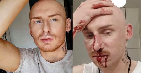 Jacek Szawiola z "Gogglebox" został POBITY: "Tak wygląda wolność w naszym kraju" (FOTO)