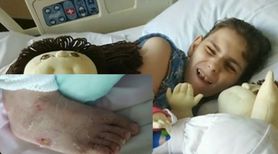 Niepełnosprawna 19-latka doznała poparzeń 3 stopnia. Jej opiekunowie wsadzili ją  do wanny z środkami chemicznymi