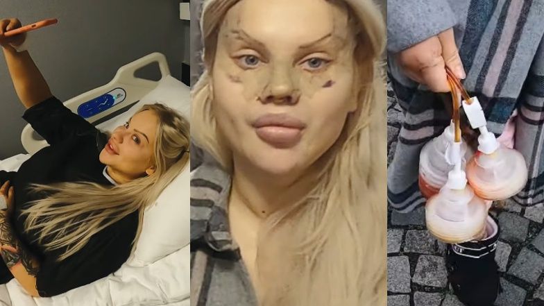 Ewel0na prezentuje film z wyprawy do kliniki w Turcji