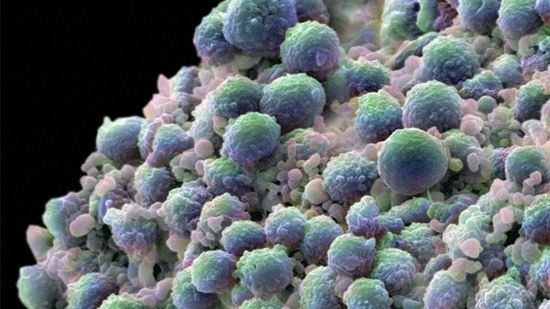 Działające lekarstwo na raka -  wreszcie! 1