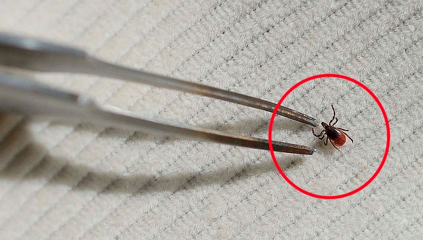 Do wyciągania kleszczy warto użyć kleszczołapek lub karty - to zmniejsza ryzyko naciśnięcia na odwłok pajęczaka