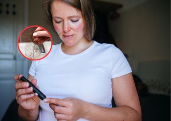 Wczesny objaw cukrzycy. Wielu zrzuca go na stres