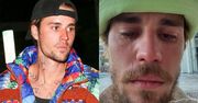 Justin Bieber ZALAŁ SIĘ ŁZAMI. Fani martwią się o stan piosenkarza (ZDJĘCIA)