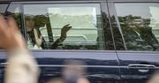 Brytyjskie media donoszą o złym stanie księżnej Kate. "Wymiotuje, ma nudności, wypadają jej włosy"