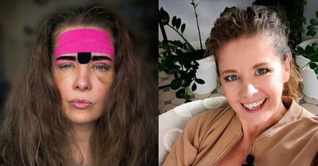Anna Powierza szybko pożałowała, że zrobiła sobie botoks: "Ruszała mi się TYLKO CZĘŚĆ TWARZY. Niekoniecznie ta, która powinna"