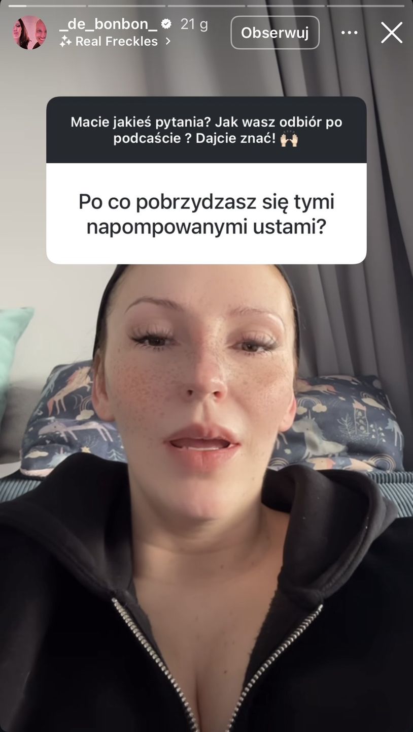 Dominika Serowska zaprzecza, że powiększyła usta
