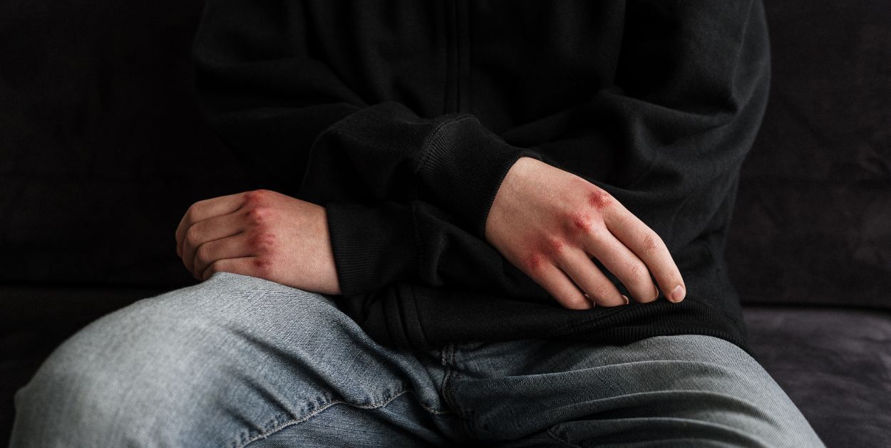Chłopcy z Płocka doświadczali potwornej przemocy, matka "myślała, że biją się między sobą"