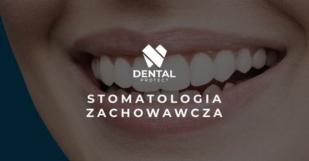 Stomatologia zachowawcza (ogólna) – leczenie próchnicy