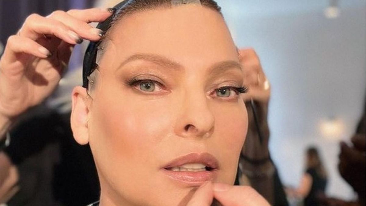 Linda Evangelista oszpecona po nieudanym zabiegu