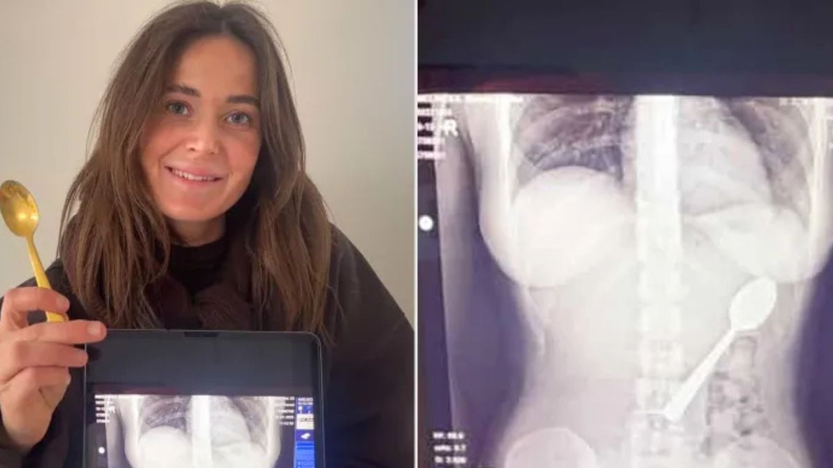 28-latka połknęła łyżeczkę