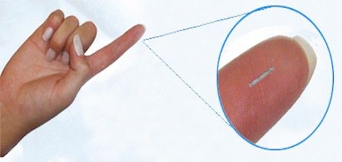Glucowizzard - maleńki, zasilany energią solarną implant do kontroli poziomu glukozy we krwi