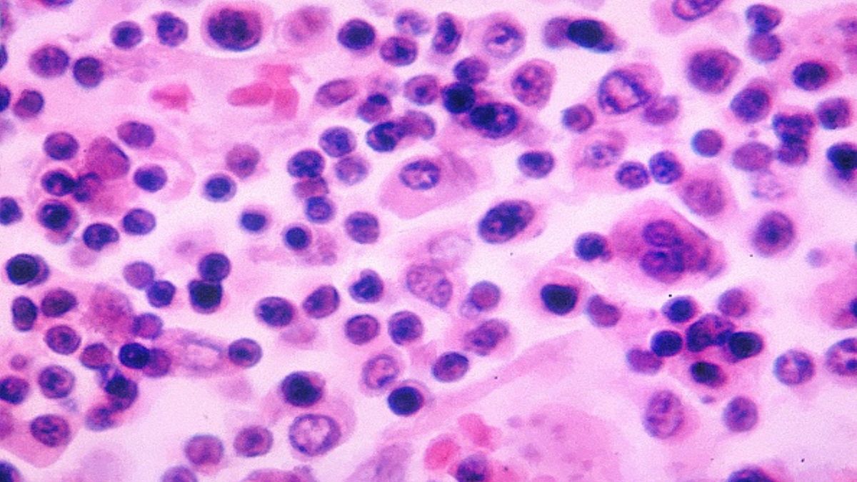 W Stanach Zjednoczonych doszło do pandemii salmonelli