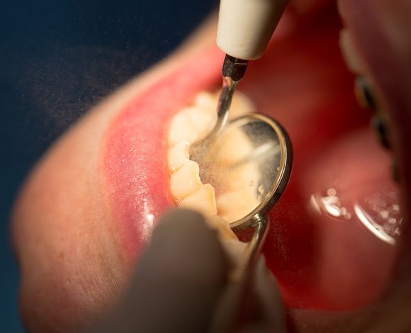 zęby dentysta