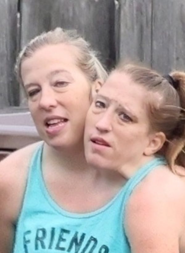 Abby i Brittany Hensel 