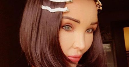 Ewa Minge wyznaje: "Zmiany na mojej twarzy nie są wynikiem operacji plastycznych, tylko wrodzonego niedorozwoju wątroby"