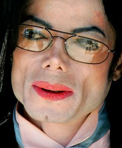 Michael Jackson: ciało króla popu przeraziło detektywa. "Łysa głowa i blizny"