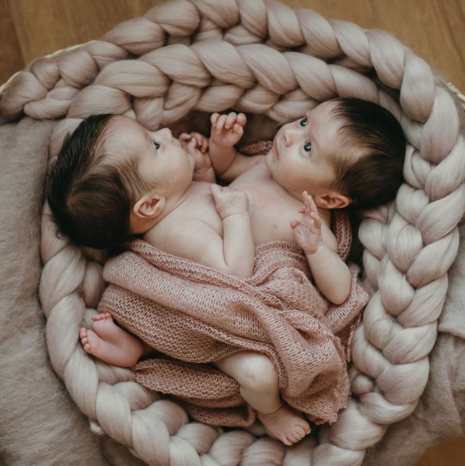 Bliźniaczki syjamskie przeszły operację rozdzielenia. Matka dziewczynek ma ważny apel