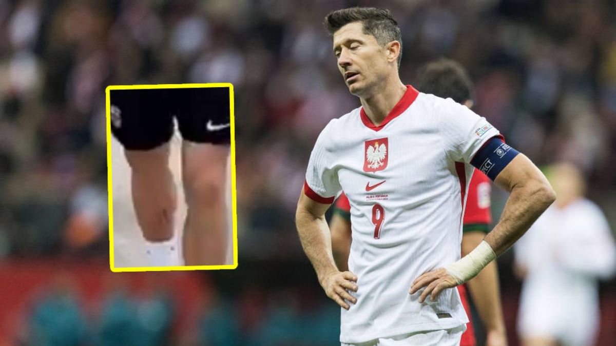 Getty Images / Foto Olimpik/NurPhoto  / Na zdjęciu: Robert Lewandowski i jego noga