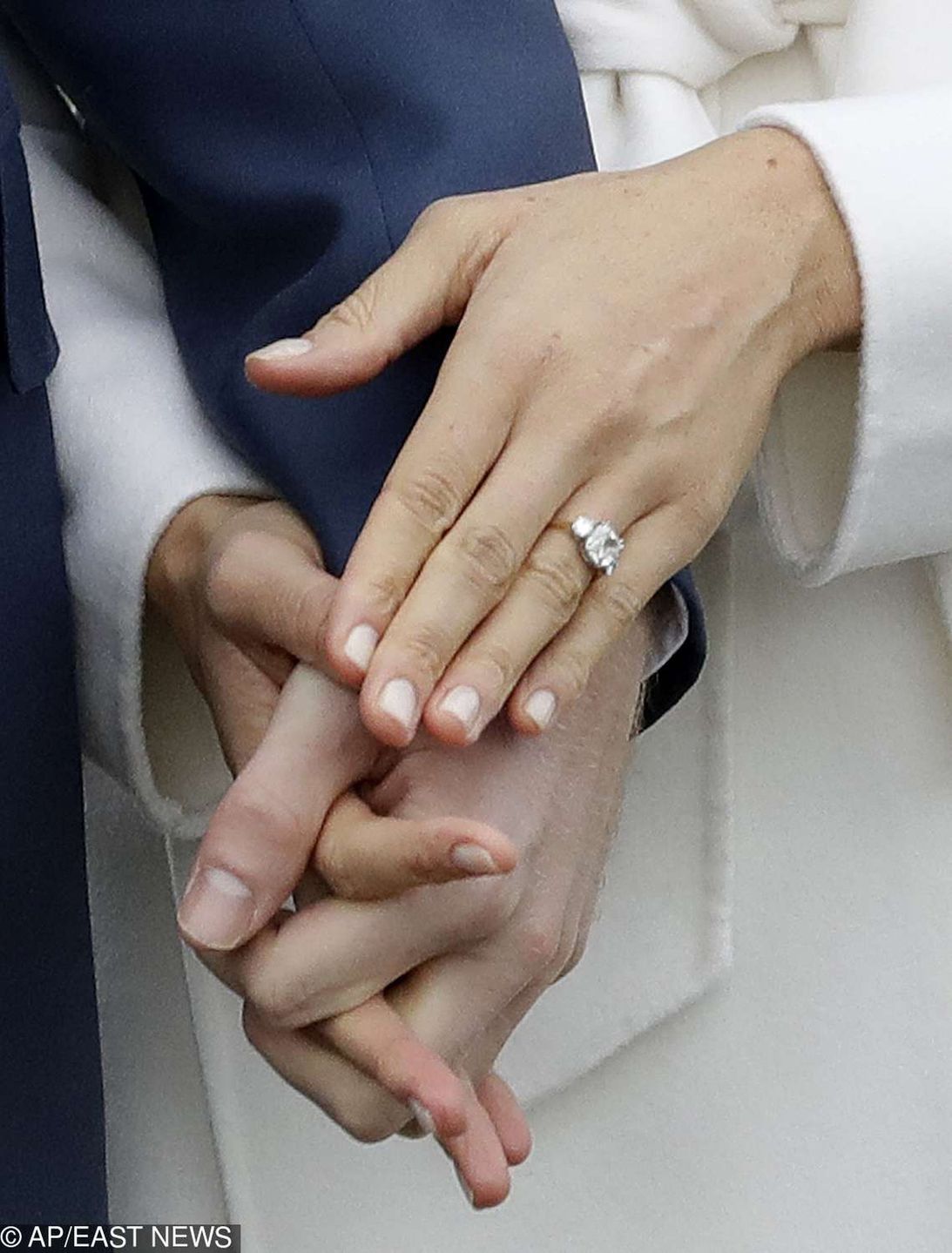 Na co choruje Meghan Markle?