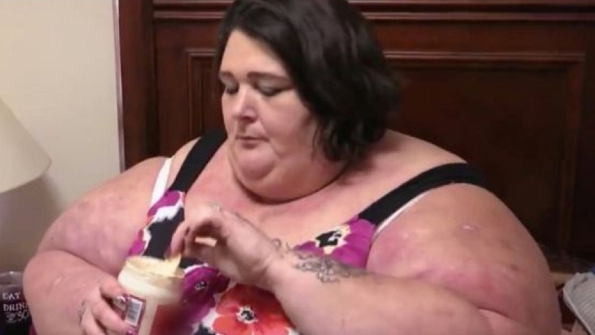 Kobieta zmarła niedługo po operacji zmniejszenia żołądka.