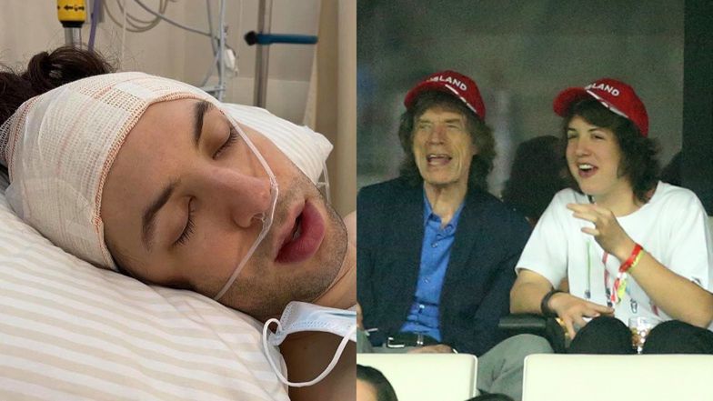 Syn Micka Jaggera pochwalił się operacją ucha