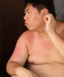 Zwolniony za otyłość