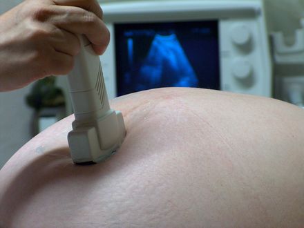 Warunki zdrowej ciąży według lekarzy