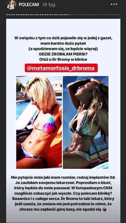 Blanka Lipińska powiększyła biust