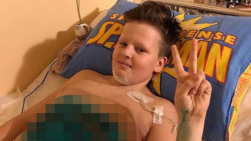 Arkady Aksenov stracił obie nogi.