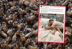 Pszczoły użądliły go 20 tys. razy. Dramat 20-latka z USA