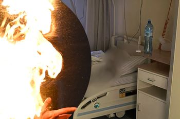 Podpalił 39-latkę, bo go rzuciła. Na szpitalnym łóżku usłyszał zarzuty