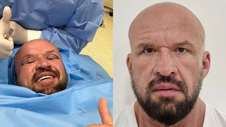 Dariusz Oświeciński zoperował powieki