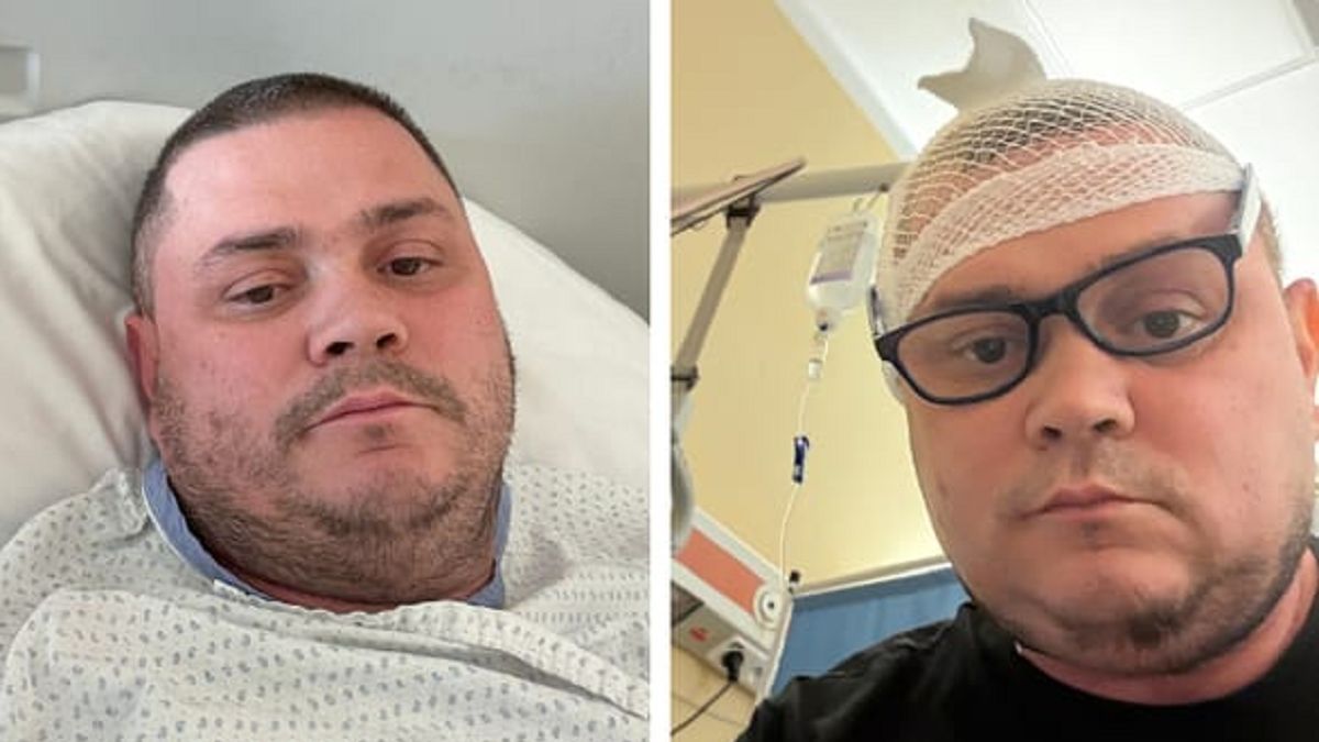 Kolejny kucharz "MasterChefa" walczy z rakiem