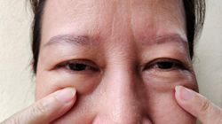 Tak tarczyca może "wołać' o pomoc. Zwróć uwagę na jeden objaw