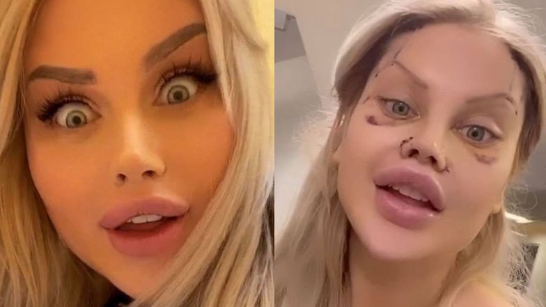 Ewel0na nawraca się w szpitalu