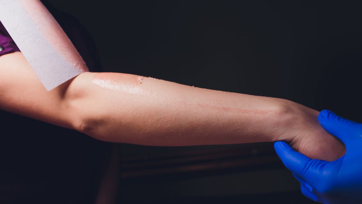 Uformowali przyrodzenie okaleczonego mężczyzny z przedramienia