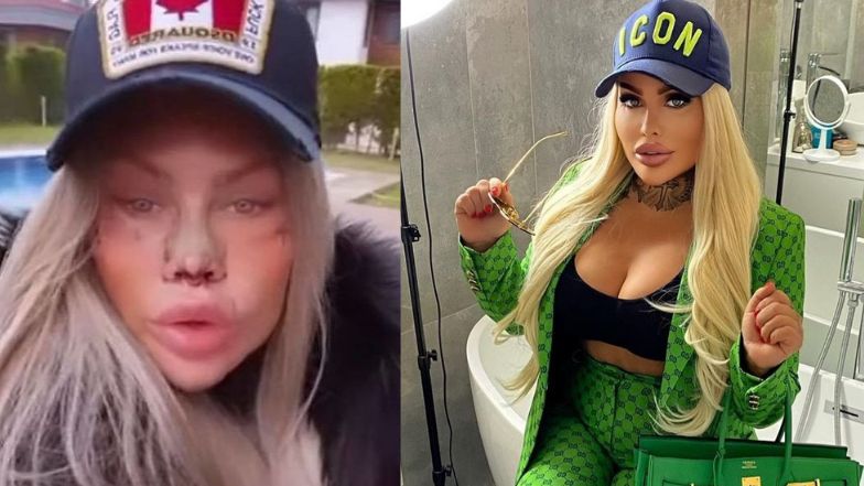 Laluna Unique: "26 lat to dobry wiek, żeby coś sobie poprawić"