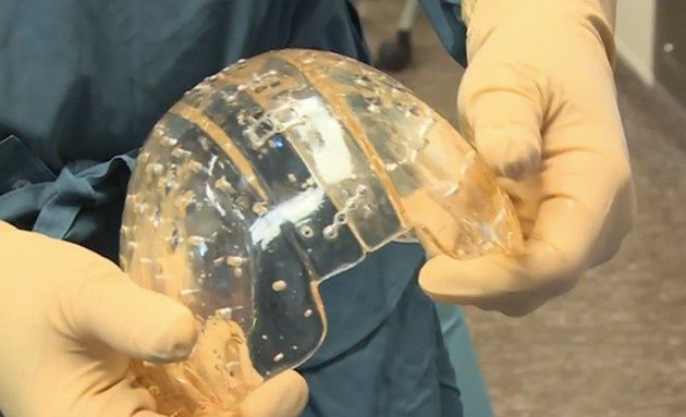 czaszka 3d